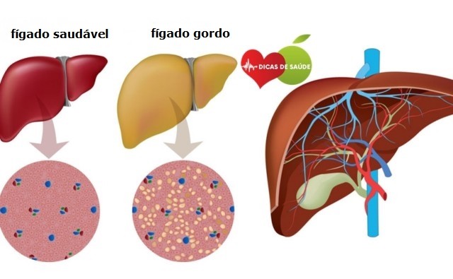 figado-alimentos-que-ajudam-a-limpar