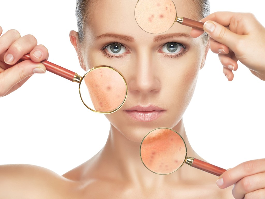 Zinco para acne: Como usar, fontes e seus benefícios do uso