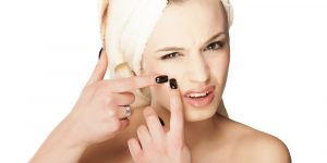 dicas para prevenir a acne no dia a dia