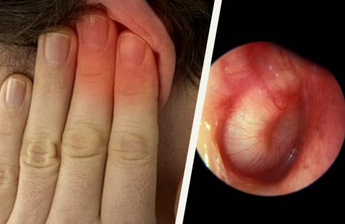 Como Tratar Infecções de Ouvido