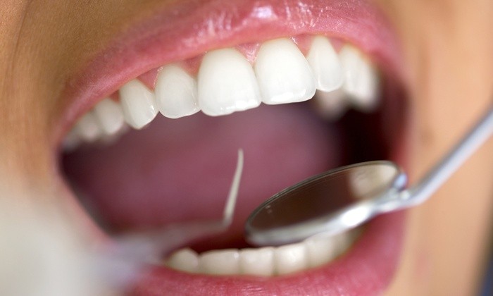 maneiras de remover a placa do seu dente em casa