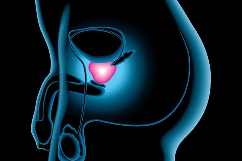 sinais de câncer de prostata