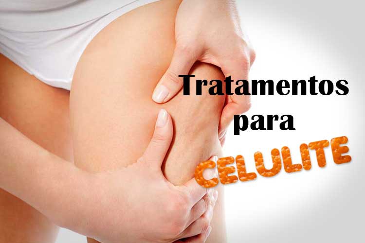 Dicas de Como Eliminar a Celulite