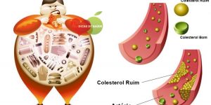 alimentos-que-reduzem-o-colesterol-e-prevenir-ataques-cardiacos-1