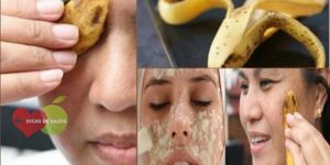 Casca de Banana Para Tratar a Acne