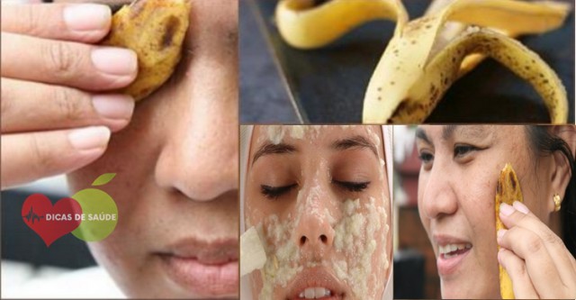 Casca de Banana Para Tratar a Acne