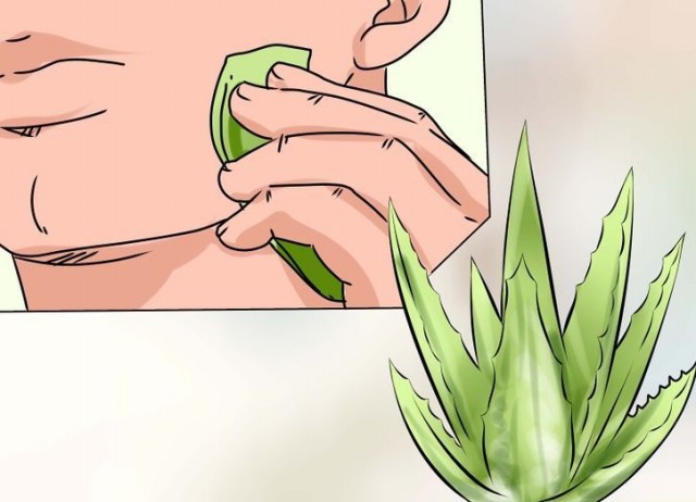 aloe vera para acne 1