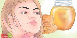 Como Usar o Mel Para Tratar Acne em Casa