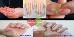 Dicas Para Fortalecer as Unhas