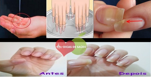 Dicas Para Fortalecer as Unhas