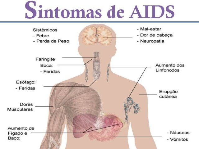 Sintomas da AIDS