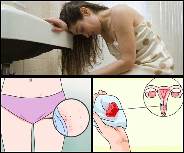 câncer de vagina sintomas