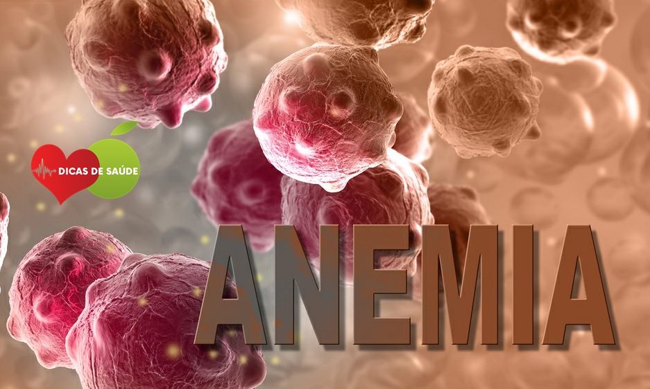 curar-a-anemia-2