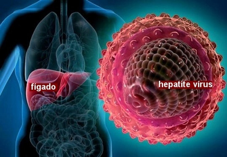 Hepatite C