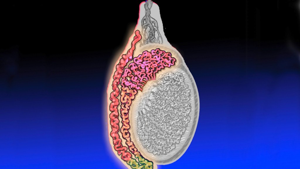 Cisto Testicular Causas