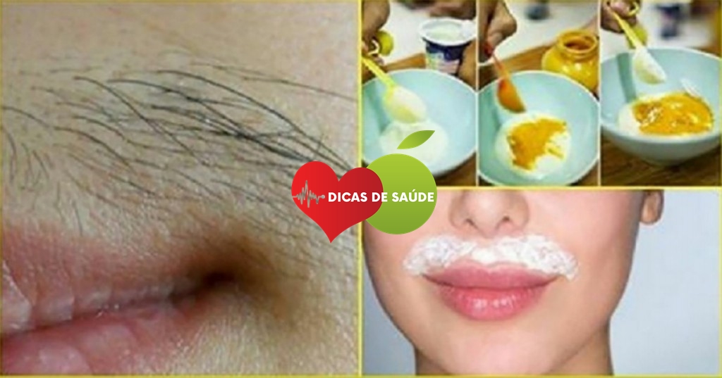 5 Receitas Simples Para Eliminar os Pelos Faciais em Casa 1