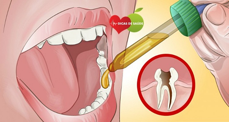 Como ACABAR com a Dor de Dente em 5 Minutos