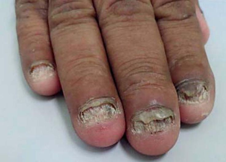 Como Acabar com as Unhas Fracas Copia