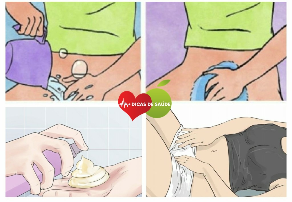 Elimine o Odor, os Fungos e as Bactérias da Vagina!