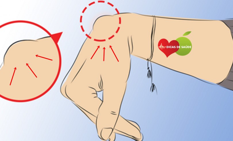 Os 4 Sintomas de Advertência que Aparece na Sua Mão!
