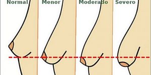 Hábitos que Fazem com que os Seios Caiam