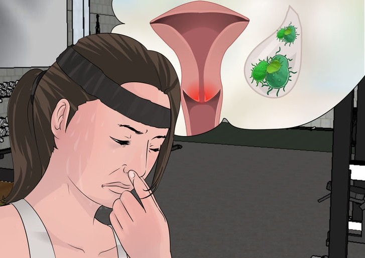 odor vaginal