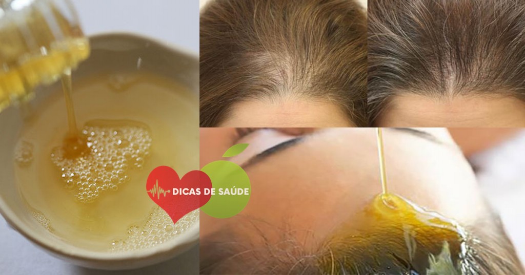 3 Receitas Caseiras Para Acelerar o Crescimento de Cabelo