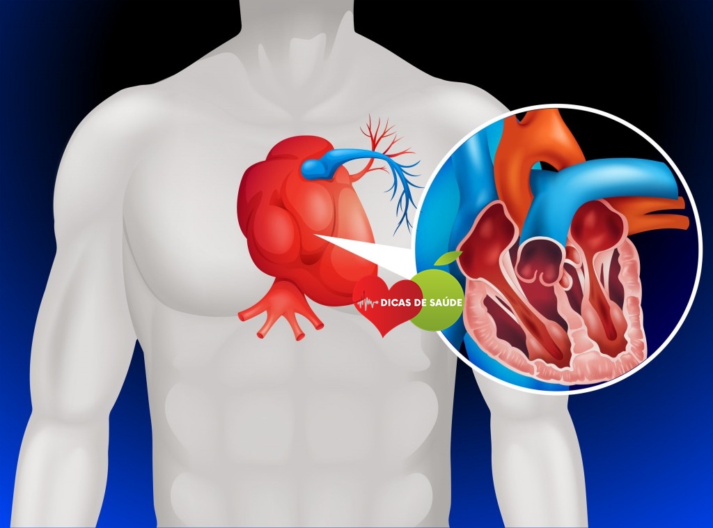 Alimentos que Ajudam a Prevenir o Ataque Cardíaco