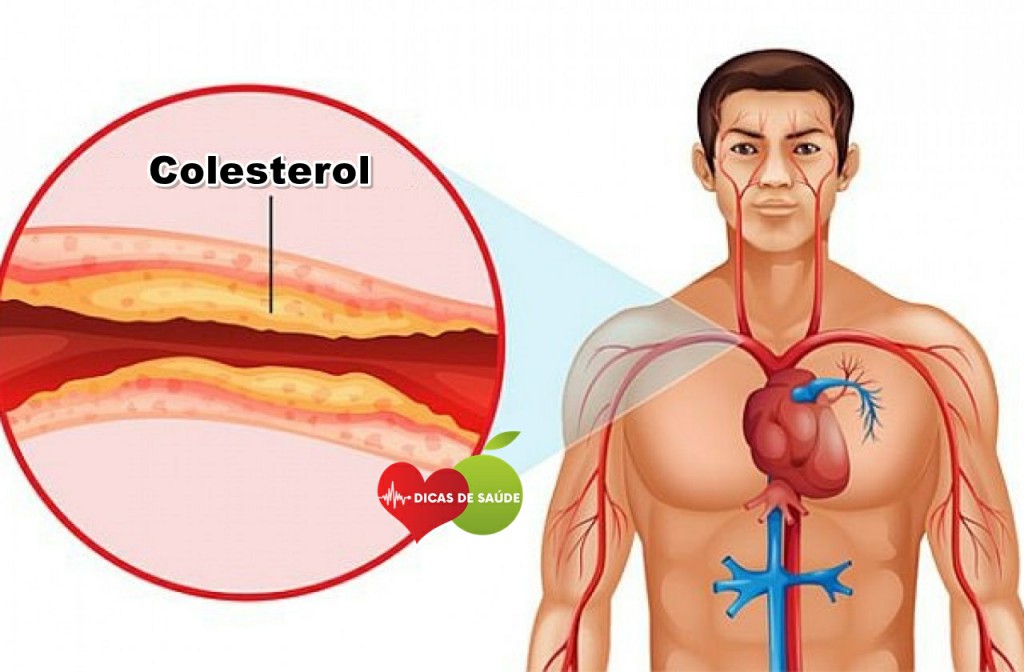 Colesterol