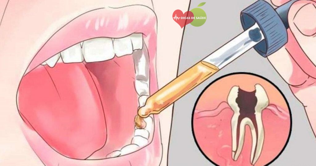 Como Aliviar a Dor de Dente Naturalmente em 10 Minutos