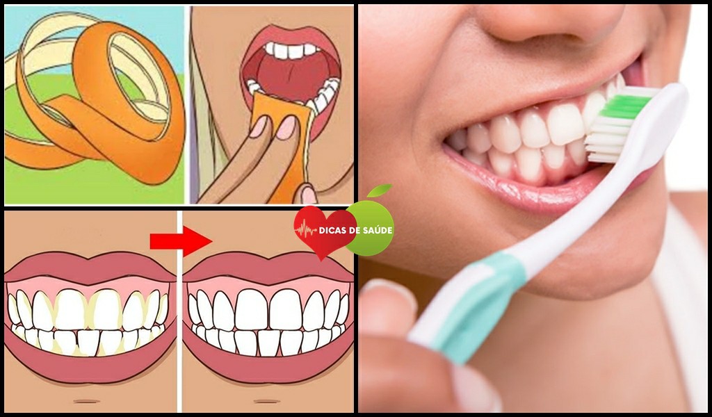 Como Clarear os Dentes 4