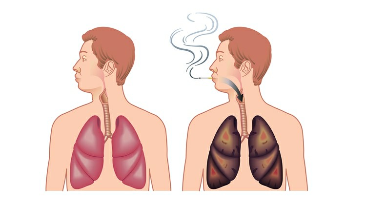 Dicas Para Parar de Fumar