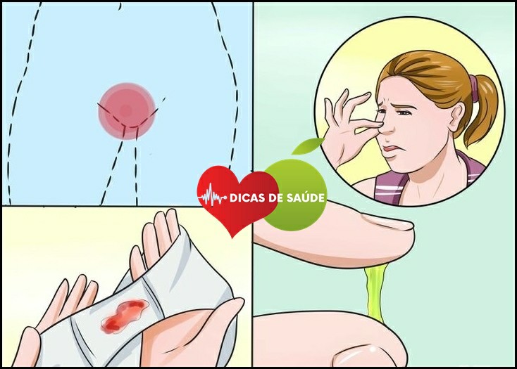 Mau Cheiro na Vagina 1