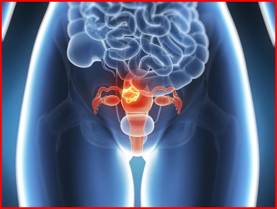Principais Sintomas de Câncer na Vagina