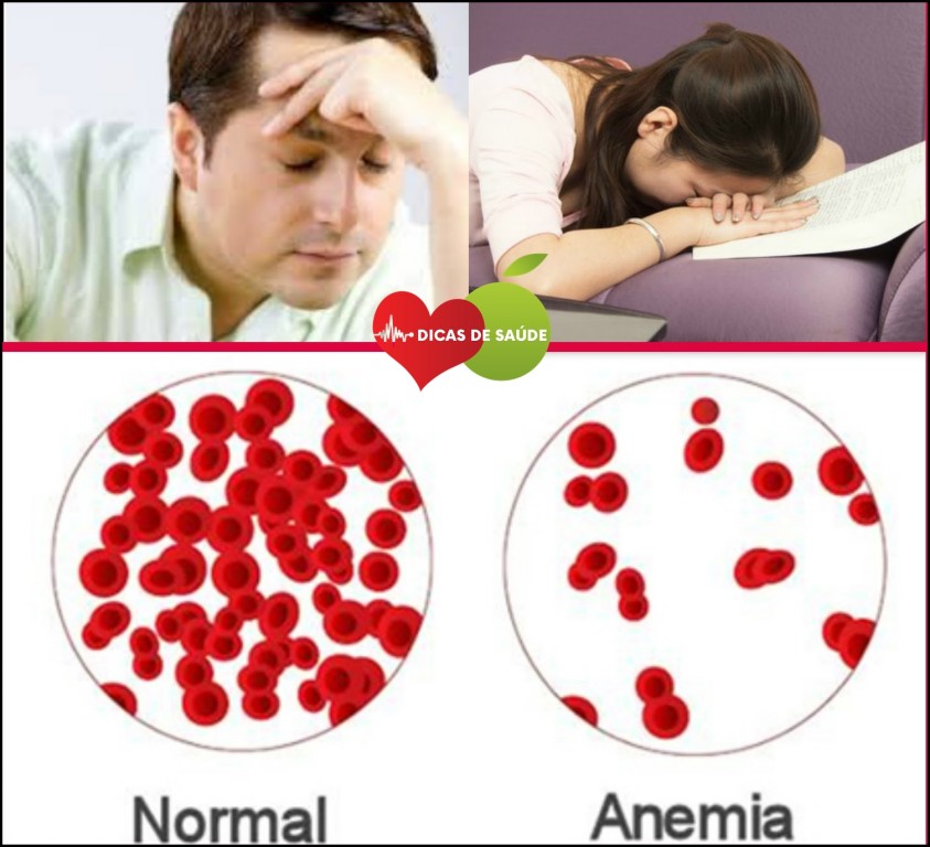 Receita Para Curar a Anemia