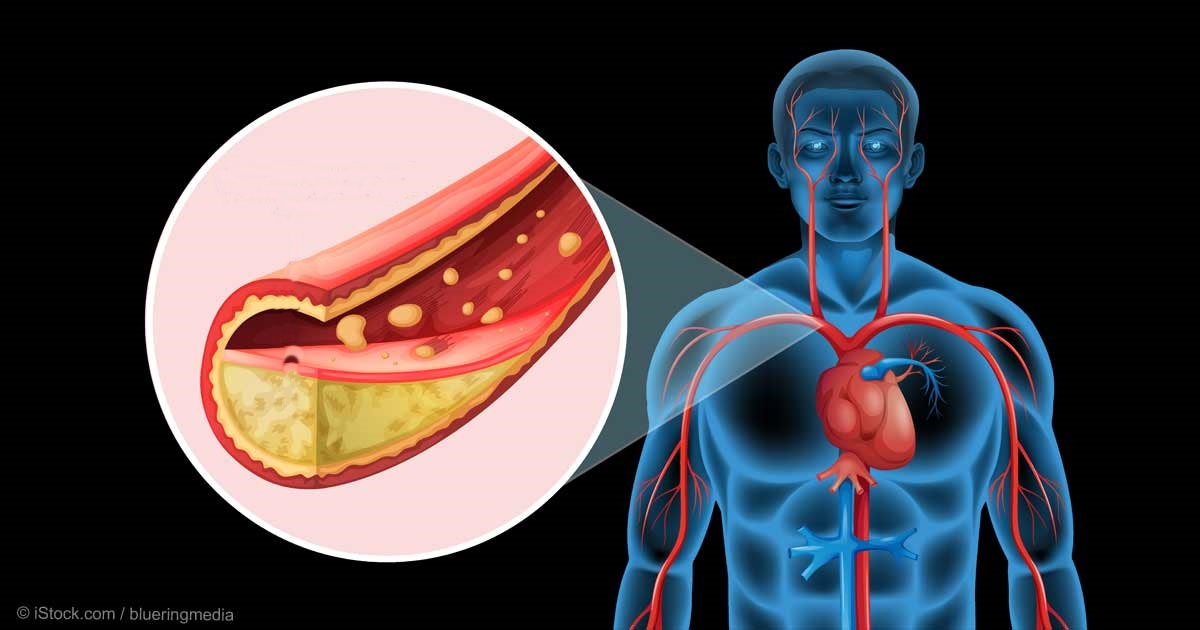 Dicas Para Baixar o Colesterol Naturalmente