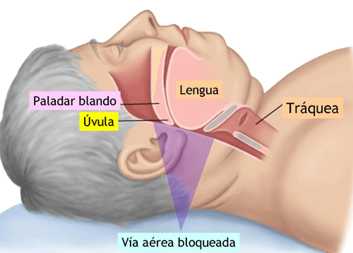 Dicas Para Acabar com o Ronco do Marido