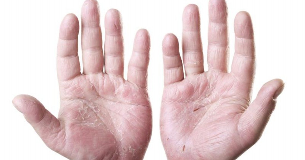 como tratar a pele seca das mãos