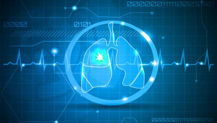 Embolia Pulmonar Sintomas