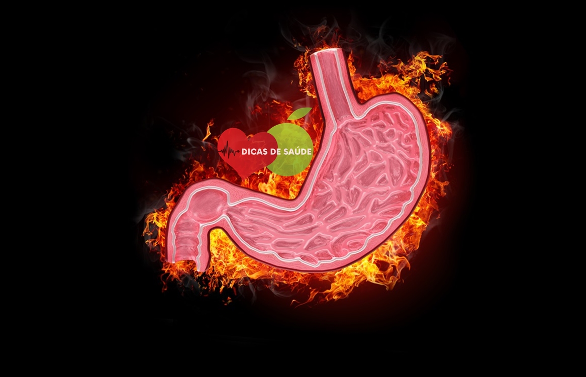 Sintomas da Gastrite