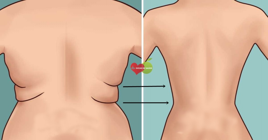 Acabar com as Gorduras nas Costas