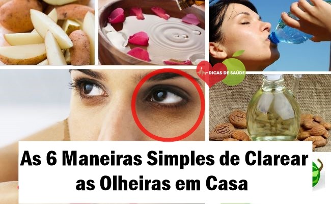 Maneiras Simples de Clarear as Olheiras