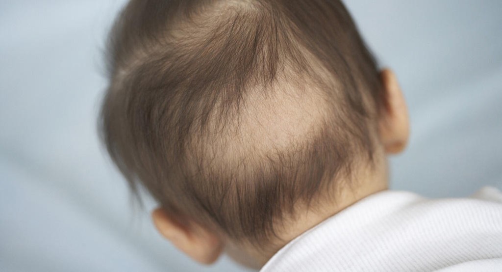 Causas da Queda do Cabelo em Crianças