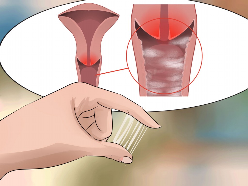 Como Eliminar Infecções Vaginais Sem Uso de Medicamentos 2