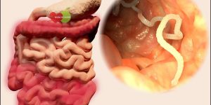 Como Eliminar Vermes Intestinais
