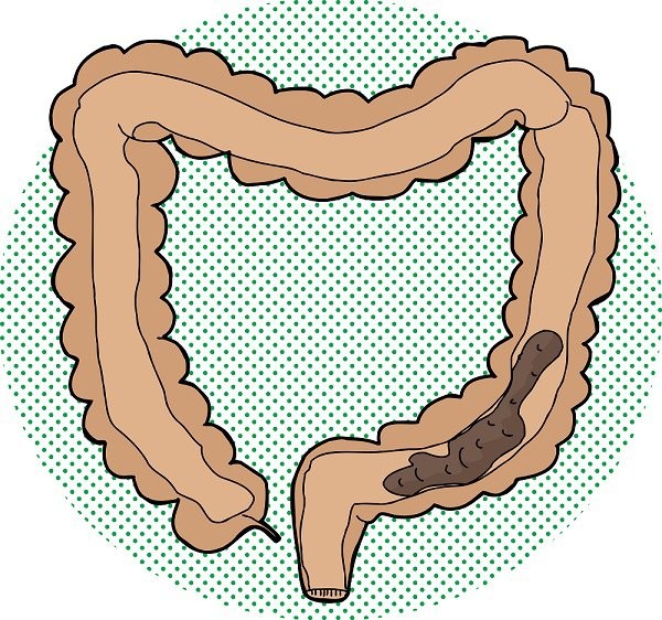 Como Fazer Limpeza Intestinal Com Vinagre e Mel