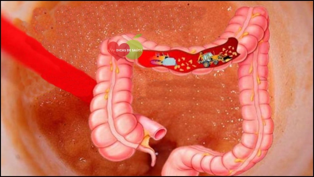 Como Limpar Toxinas Intestinais Naturalmente