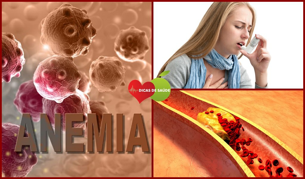 Como Tratar a Asma Colesterol e Anemia 3