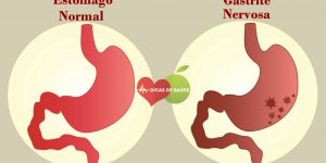 Curar a Gastrite Nervosa