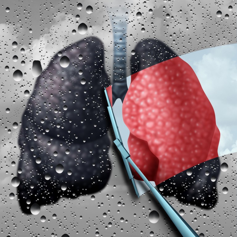 Dieta para desintoxicar os pulmões: funciona? como fazer e benefícios